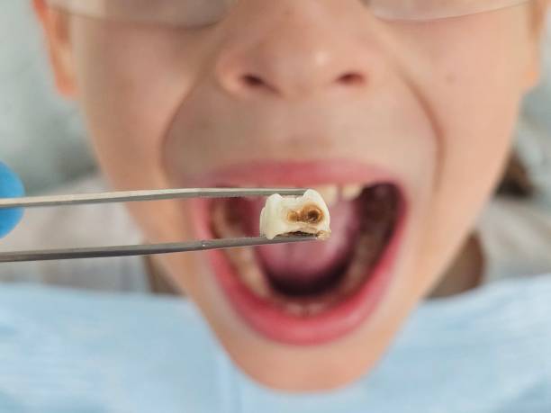 Best Emergency Treatment for Jaw Pain or Injury in Chewelah, WA